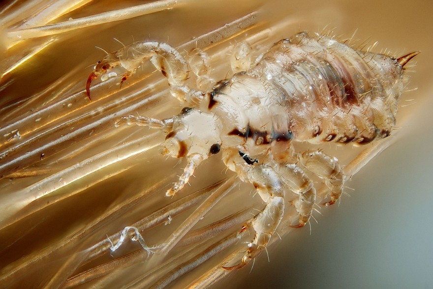 Lice (like this human head louse) can result in severe hair loss for deer.